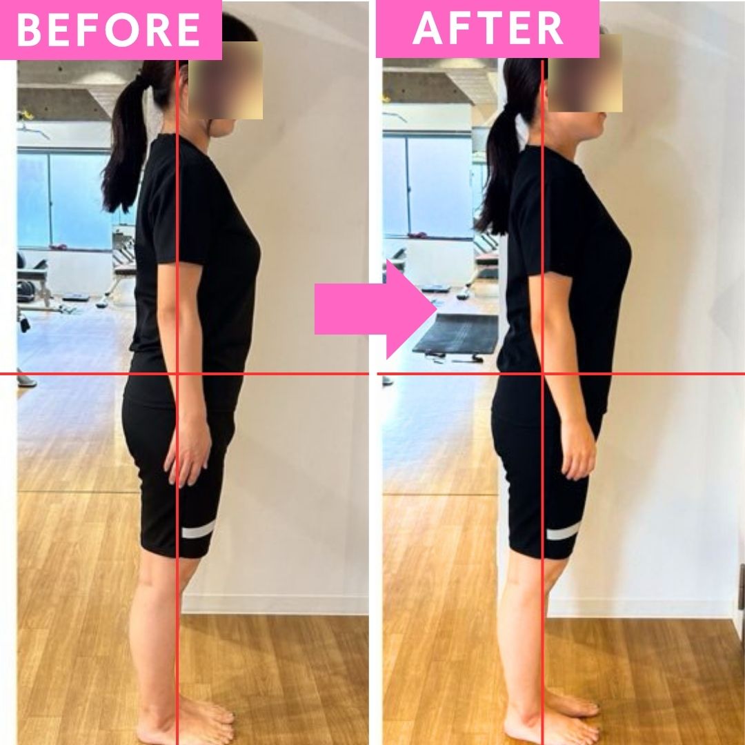 ビフォーアフター メイン