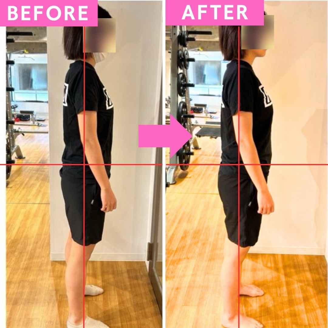 ビフォーアフター2