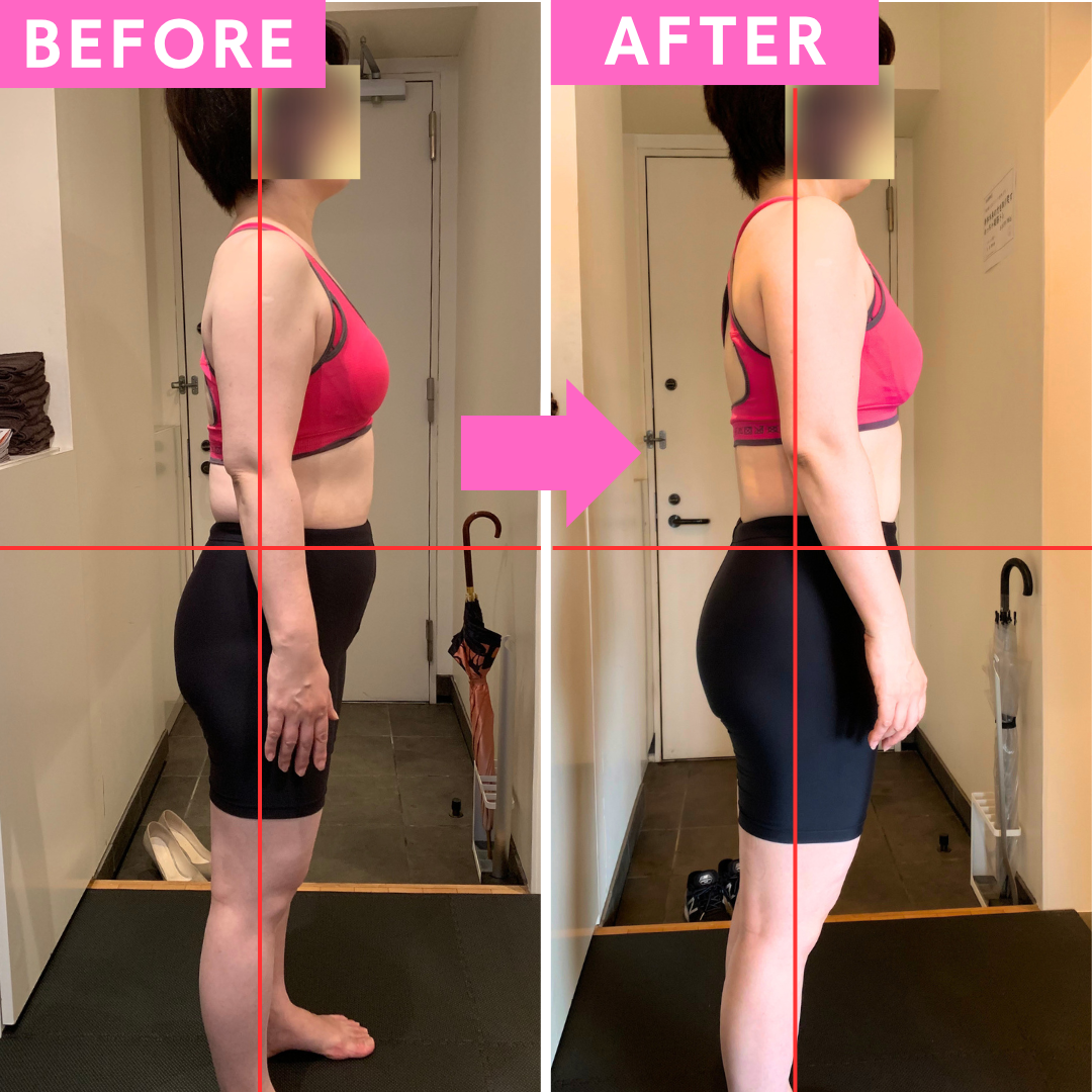 H.K.様 50代 会社員 ビフォーアフター