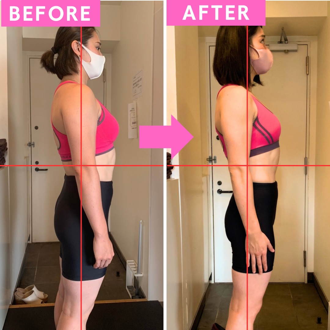 山口美咲様 30代 元オリンピック選手 ビフォーアフター